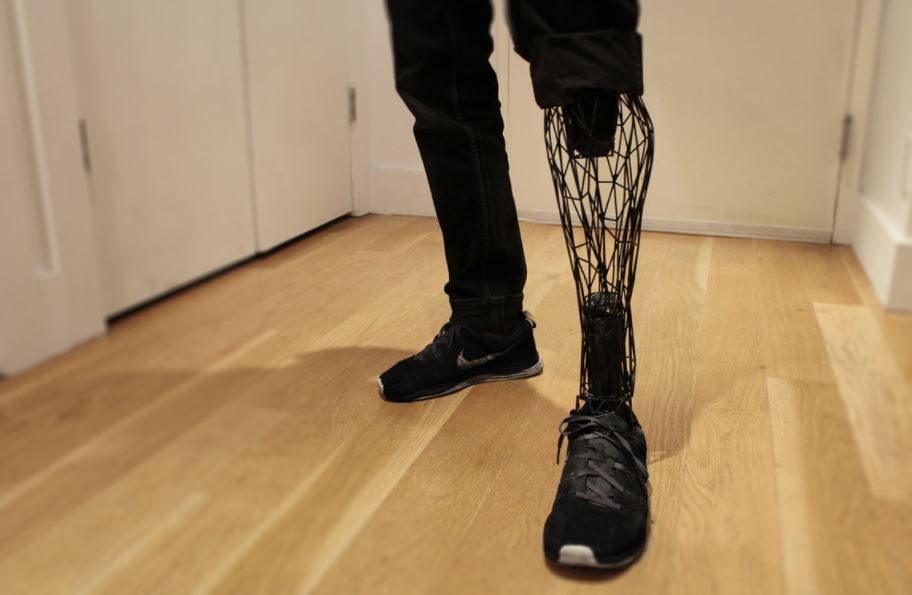 3d printed prosthesis