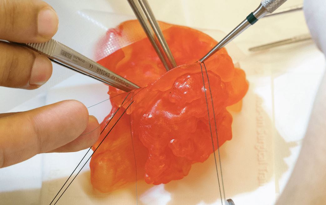 Operating on 3d Printed Surgical Model